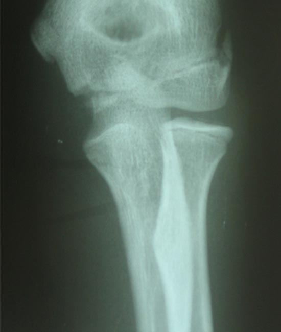 rehabilitative-schmerzbehandlung-roentgen